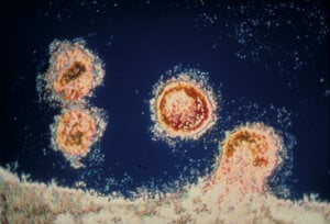 FrancoiseBarre Sinoussi DISCOVERY asset15