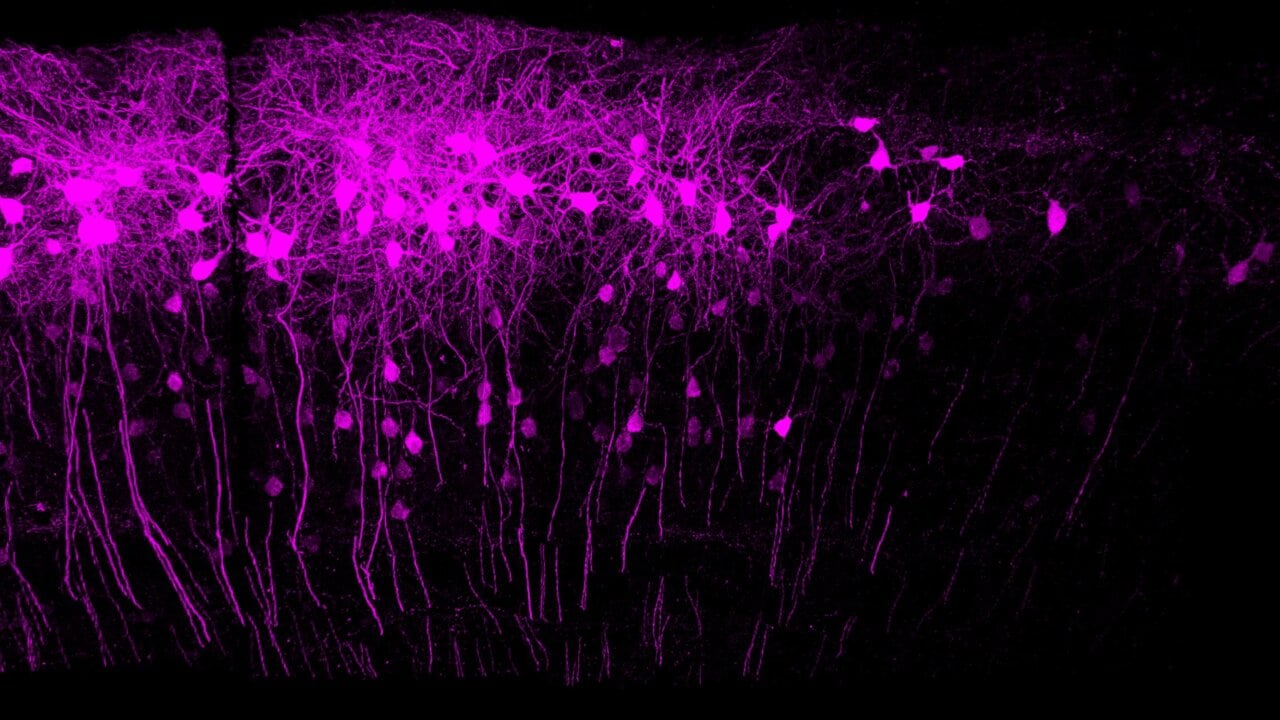 Photo of neurons