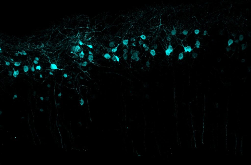 Viral labelling of neurons
