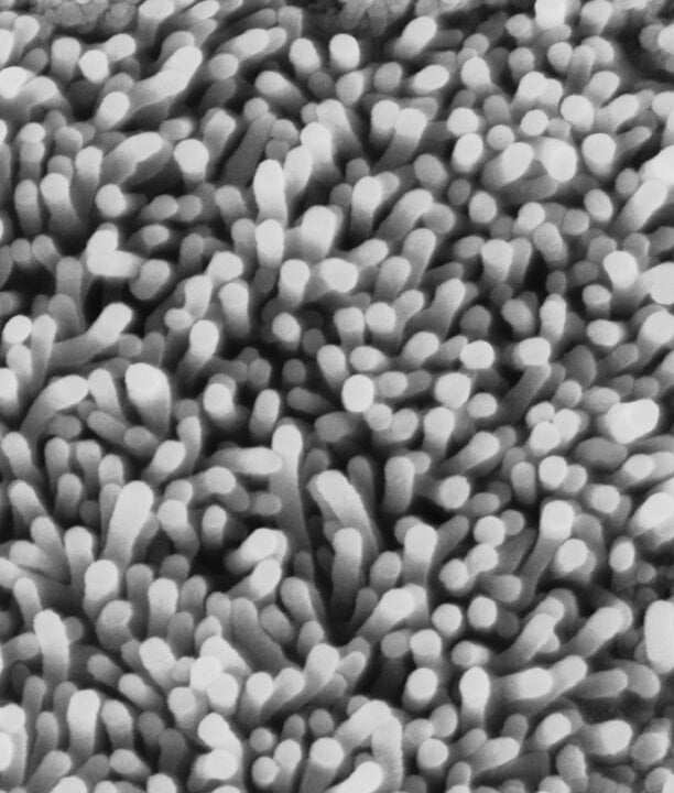 Nasopharynx surface as seen in a scanning electron micrograph