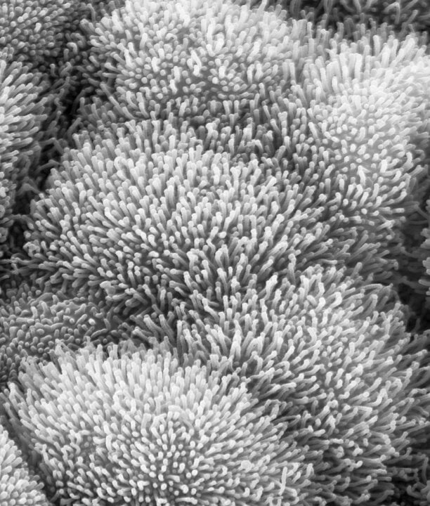 Nasopharynx surface as seen in a scanning electron micrograph