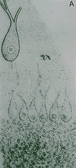 Purkinje cell