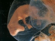 embryo
