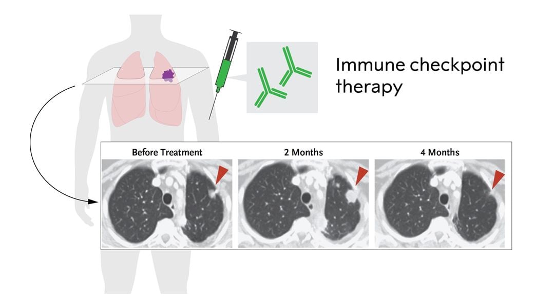 Immune checkpoint therapy