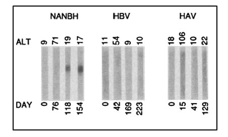 Immunoblots with sequential serum samples