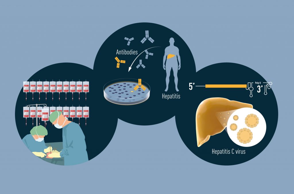 Hepatitis illustration