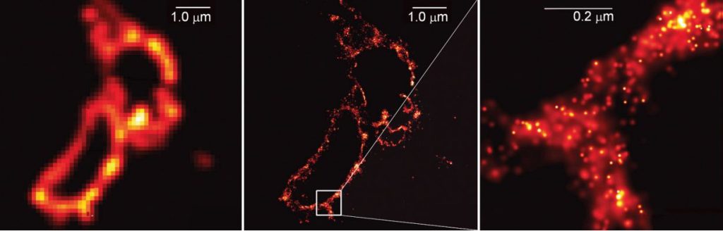 Images of lysosome membranes