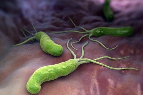 An illustration of helicobacter pylori