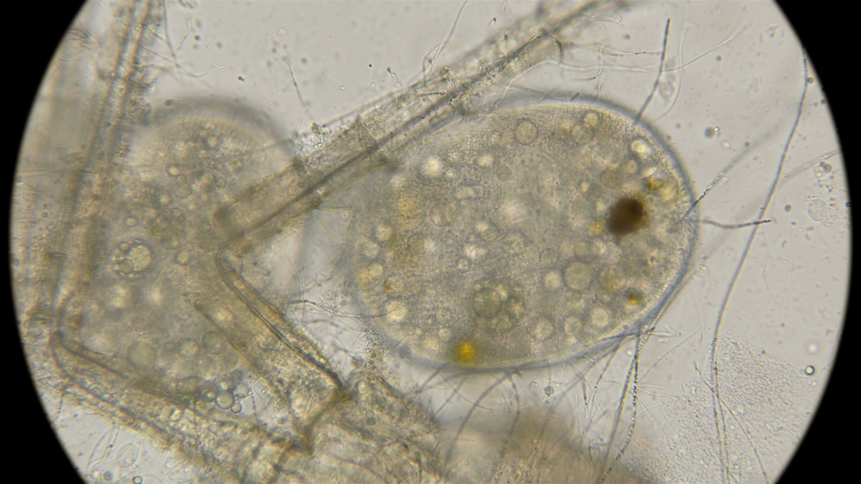 Single-celled Tetrahymena
